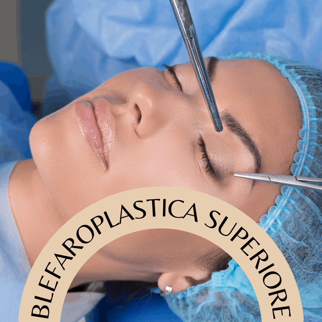 Blefaroplastica Superiore
