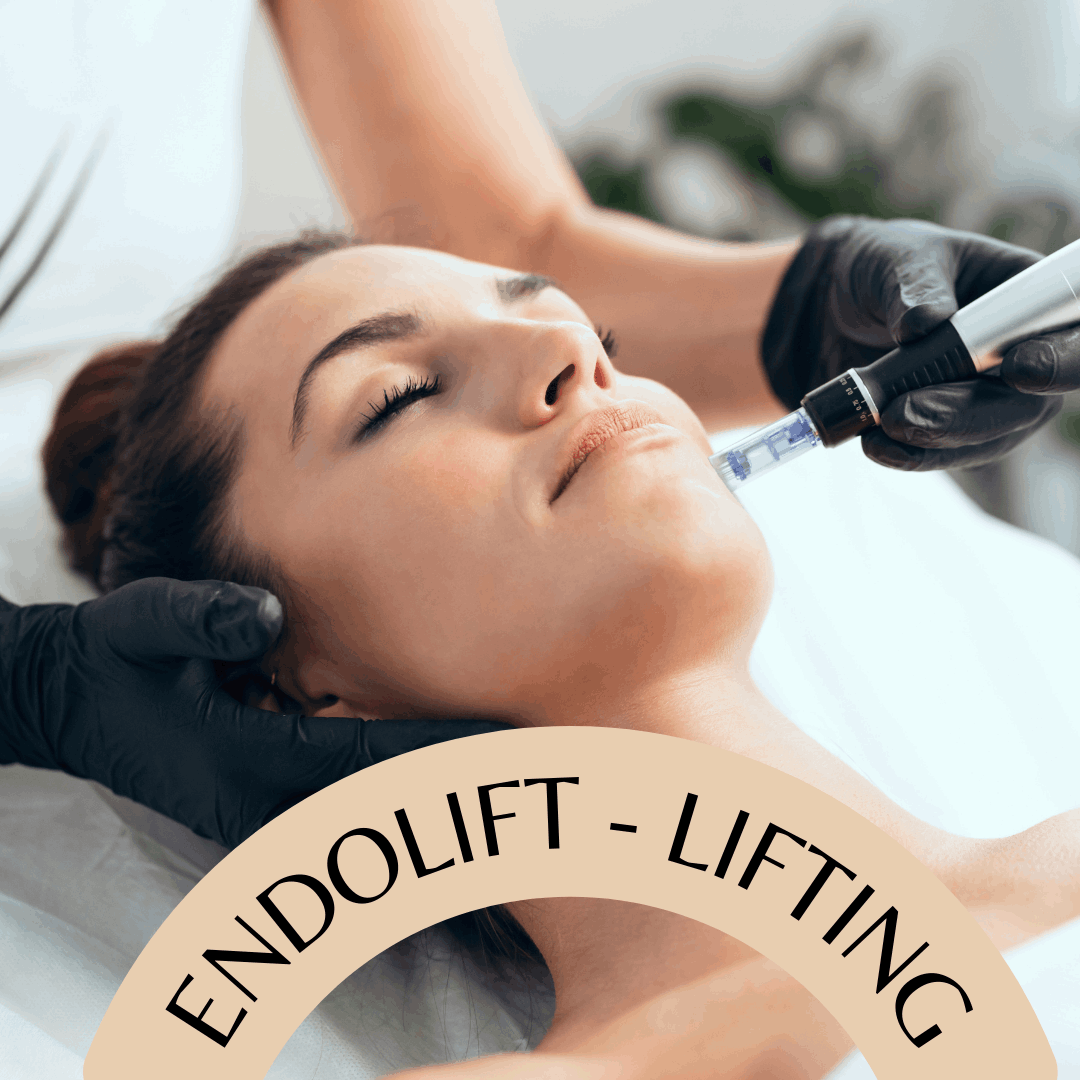 Endolift