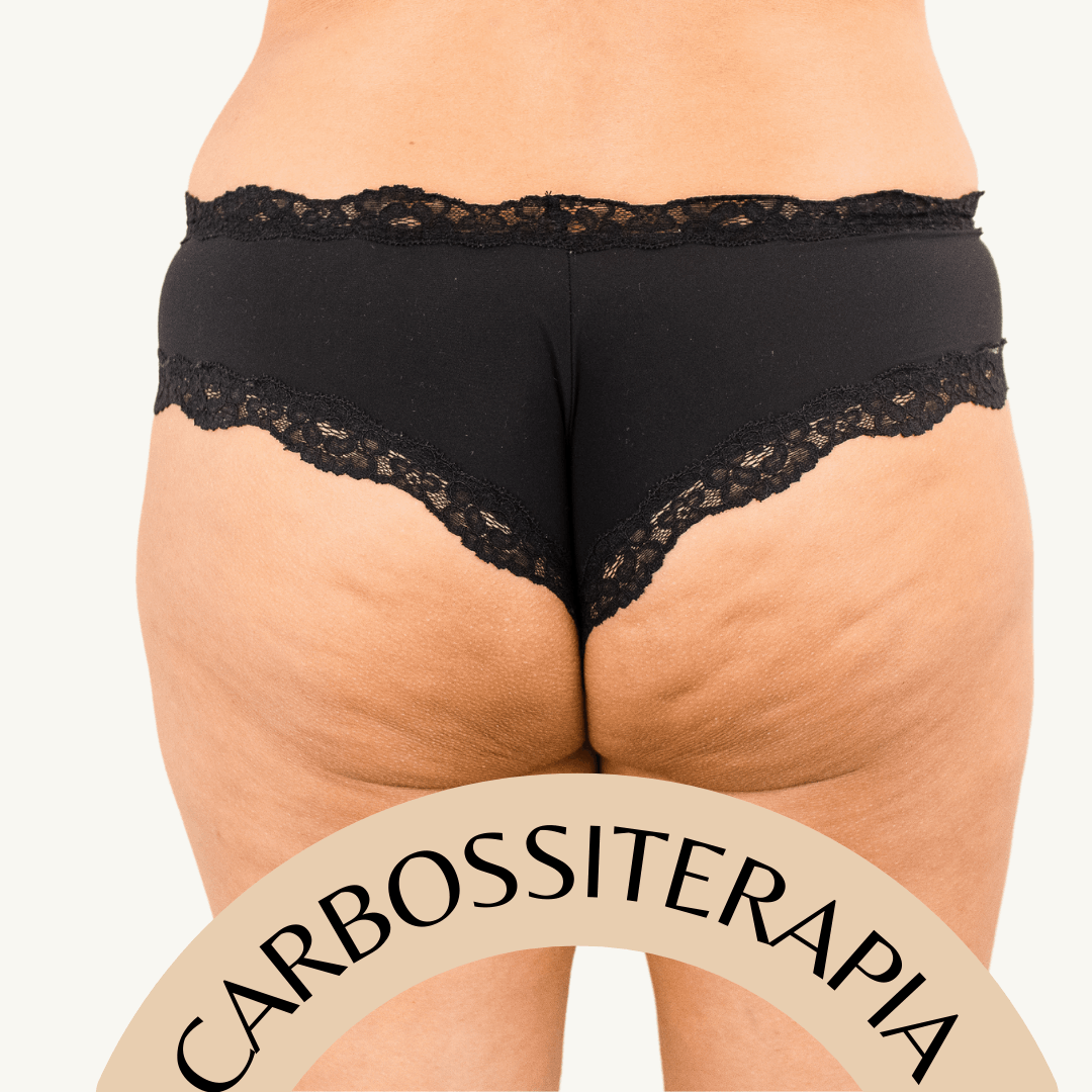 Carbossiterapia