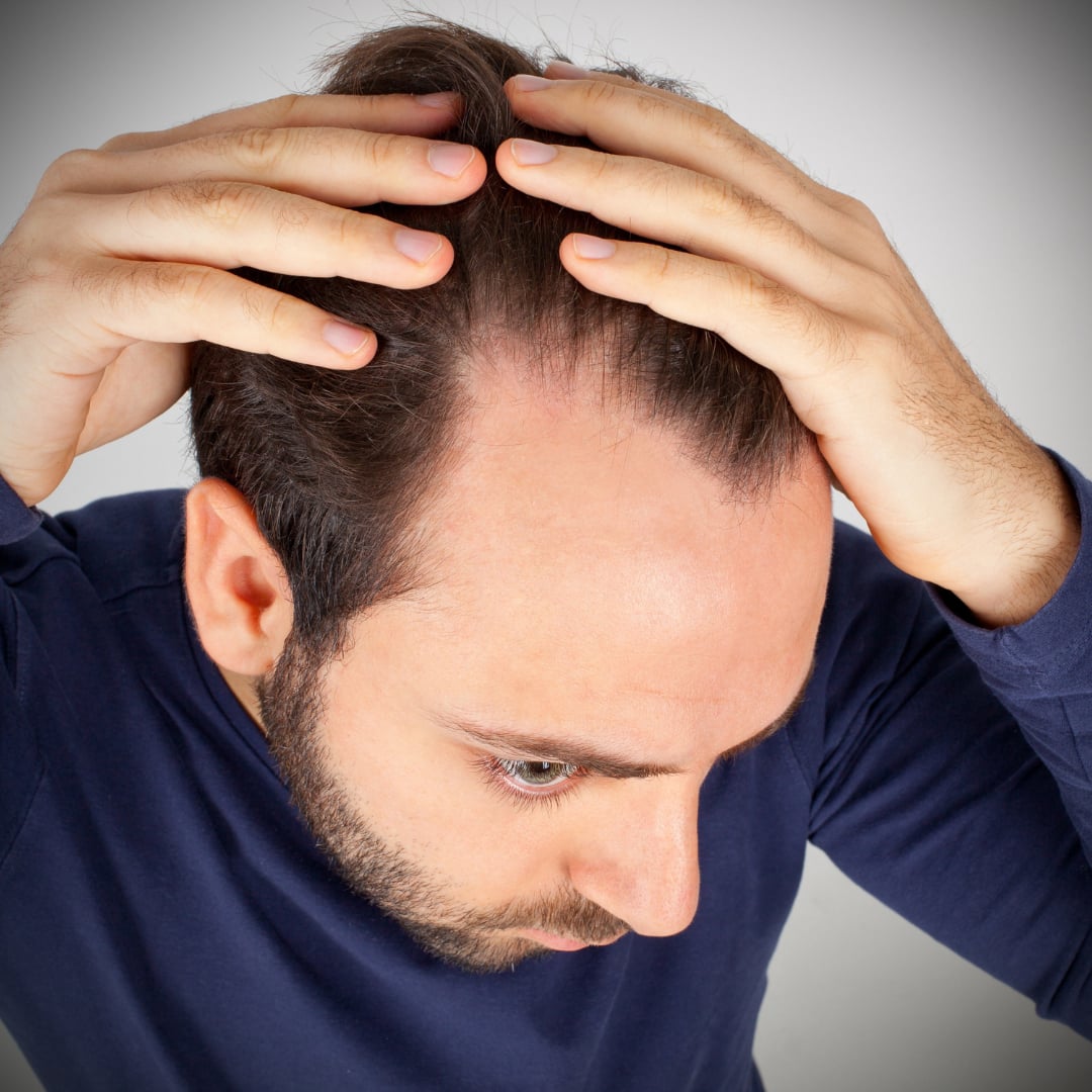 Alopecia Balance Clinic